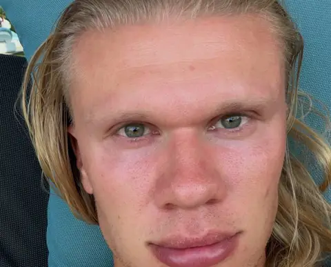 Viral Health Campaign Explains the Menstrual Cycle to Men Using Erling Haaland Memes